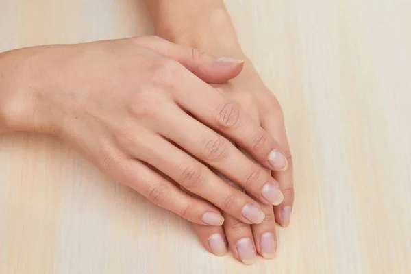 Manos femeninas con uñas naturales cortas . —  Fotos de Stock