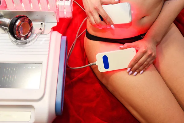 Laser Liposukcji Kosmetologia Sprzętu Opieka Ciała Niechirurgiczne Rzeźbienie Ciała Leczenie — Zdjęcie stockowe