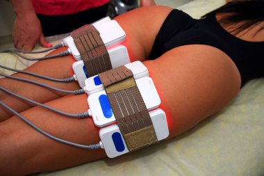 Lipo lazeri. Donanım kozmetolojisi. Vücut bakımı. Cerrahi olmayan vücut şekillendirme. Güzellik salonunda vücut şekillendirme tedavisi, anti-selülit ve anti-yağ terapisi.