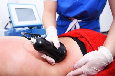 Rf derisi sıkışıyor. Süpürge masajı. Donanım kozmetolojisi. Vücut bakımı. Cerrahi olmayan vücut şekillendirme. Güzellik salonunda anti-selülit ve anti-yağ tedavisi.