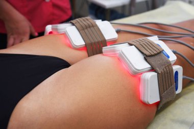 Lipo lazeri. Donanım kozmetolojisi. Vücut bakımı. Cerrahi olmayan vücut şekillendirme. Güzellik salonunda vücut şekillendirme tedavisi, anti-selülit ve anti-yağ terapisi.