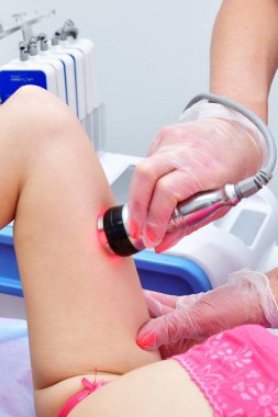 Rf derisi sıkışıyor. Süpürge masajı. Donanım kozmetolojisi. Vücut bakımı. Cerrahi olmayan vücut şekillendirme. Güzellik salonunda anti-selülit ve anti-yağ tedavisi.