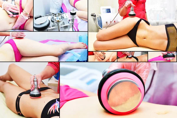 Tensado Piel Vientre Cosmetología Hardware Tratamiento Contorno Corporal Cavitación Por — Foto de Stock