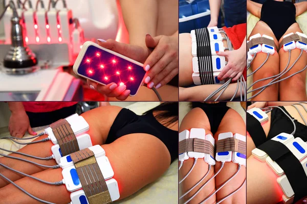 lipo lazer. Donanım kozmetolojisi. Vücut bakımı. Cerrahi olmayan vücut şekillendirme. vücut şekillendirme tedavisi, anti-selülit tedavisi. Vücudun farklı parçaları ile büyük kolaj.