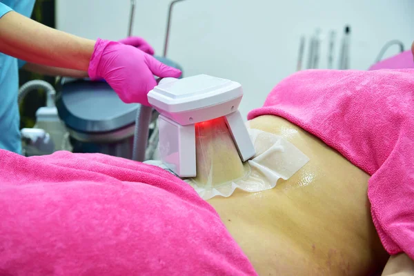 Kriyolipolisis. Donanım kozmetolojisi. Vücut bakımı. Cerrahi olmayan vücut şekillendirme. Vücut geliştirme tedavisi, güzellik salonunda anti-yağ terapisi.. 