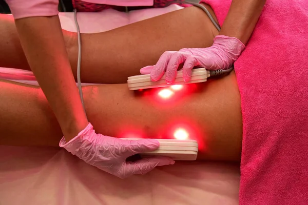 Lipo Laser Hardware Cosmetology Body Care Non Surgical Body Sculpting — Stock Photo, Image