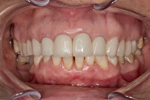 Sonríe Dentista Dientes Artificiales —  Fotos de Stock