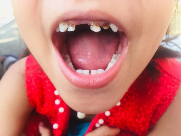 Una Niña Con Boca Abierta Que Muestra Sus Dientes Para —  Fotos de Stock