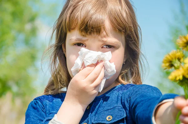 Alergi musiman pada seorang anak. Coryza. Fokus selektif . — Stok Foto