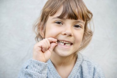 The kid had a baby tooth. Selective focus. clipart