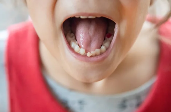 その子は赤ん坊の歯を持っていた。選択フォーカス. — ストック写真