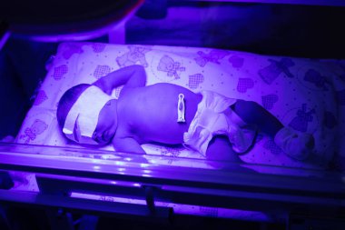 Ultraviyole lamba altında yeni doğmuş bir bebek. Seçici odaklanma. insanlar.