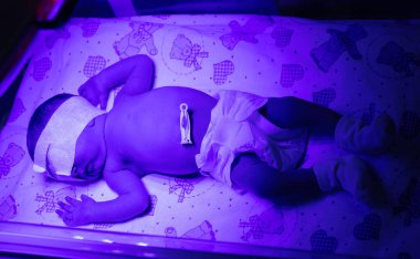 Ultraviyole lamba altında yeni doğmuş bir bebek. Seçici odaklanma. insanlar.