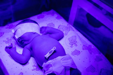 Ultraviyole lamba altında yeni doğmuş bir bebek. Seçici odaklanma. insanlar.