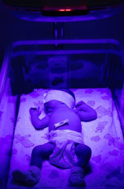 Ultraviyole lamba altında yeni doğmuş bir bebek. Seçici odaklanma. insanlar.