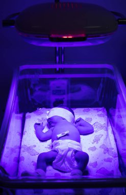 Ultraviyole lamba altında yeni doğmuş bir bebek. Seçici odaklanma. insanlar.