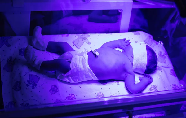 Ultraviyole lamba altında yeni doğmuş bir bebek. Seçici odaklanma. insanlar.