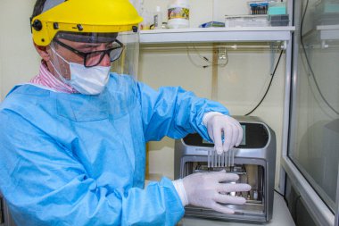 Laboratuvar yükleme test borularında biyokimya çalışması