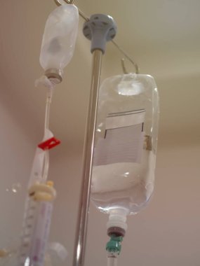 Damar içi için sodyum klorür çözeltisi, kan damarları yoluyla sodyum klorür solüsyonu ve gerekli sodyum klorür yenileme nasıl olur?