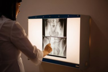 Kadının ışık yüzeyine x-ray film koyduğu yakın çekim.