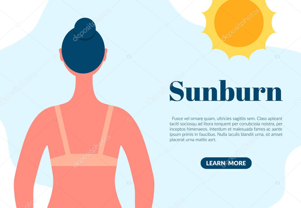 Sunburned woman back view cartoon character. Sun tanning danger concept. Skin redness flat vector illustration