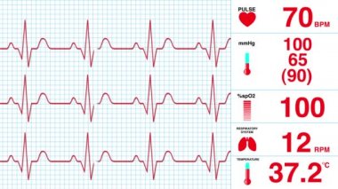 EKG Ekranı