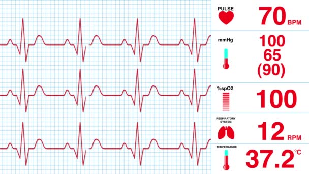 EKG képernyő — Stock videók