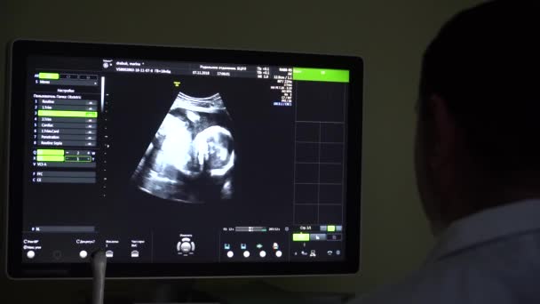 Läkare Gör Ultraljudsundersökning Gravid Kvinna — Stockvideo