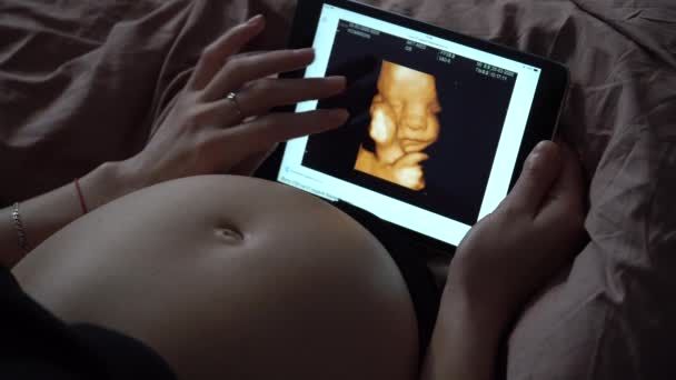 Mujer Embarazada Mira Foto Ultrasonido Computadora Tableta — Vídeo de stock