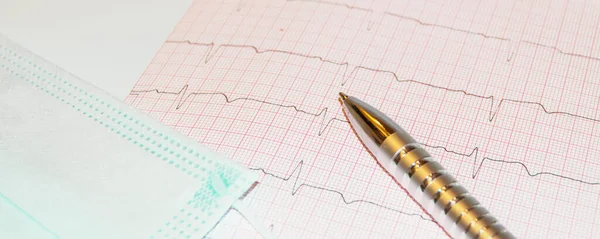 심박수 결과는 심전도와 펜을 그래프로 나타내며, 의학 연구 결과를 분석 함 — 스톡 사진