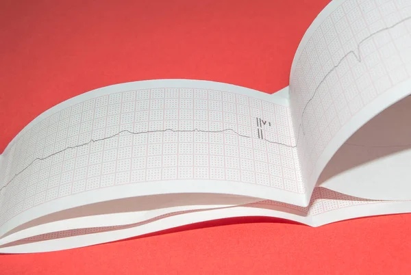 Heart rate on paper for recording an electrocardiogram, prevention of heart diseases.Electrocardiogram, waveform from EKG test, showing the patients heart rhythm