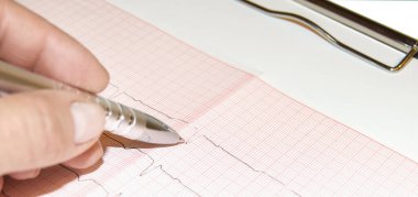 Sağlık ve tıbbi konsept - kadın doktor elleri kardiyogramda kalem tutma üzerine çalışıyor
