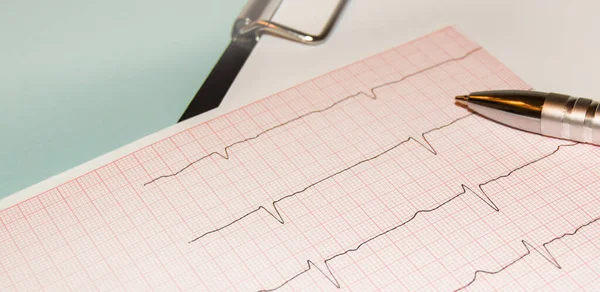 심박수 결과는 심전도와 펜을 그래프로 나타내며, 의학 연구 결과를 분석 함 — 스톡 사진