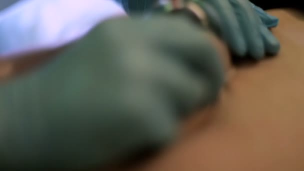 Médecin faisant femme anti-cellulite thérapie de massage sous vide sur son ventre 