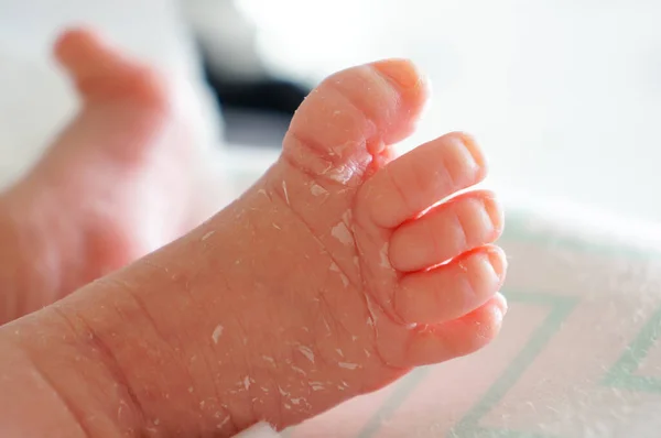 Różowe Nogi Noworodka Łuszczącej Się Skóry — Zdjęcie stockowe