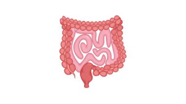 İnsan bağırsaklarını etkileyen divertiküloz hastalığının tıbbi animasyonu hem beyaz hem de yeşil ekran arka planında sunulmuştur.