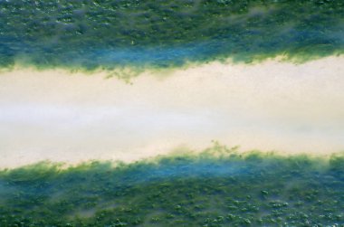 Sahilde deniz çevre kirliliği yeşil algler