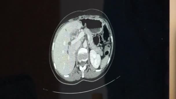 三个头部视图的 Mri 核磁共振脑部扫描 计算机断层扫描 — 图库视频影像
