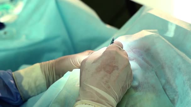 医生手上眼科手术 眼科手术 白内障手术 医生在眼科手术室 外科医生的手在手套进行激光视力矫正 — 图库视频影像