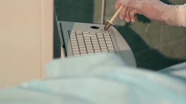 Lekarz Pracujący Klawiaturze Operacja Oka Lekarz Okulistyczny Dłonie Chirurga Rękawiczkach — Wideo stockowe