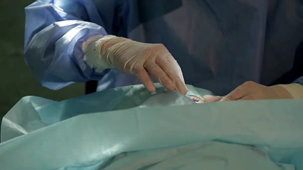 Mãos Médico Sobre Operação Oftálmica Operação Olho Cirurgia Catarata Médico — Vídeo de Stock