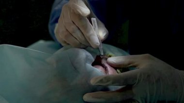 Ameliyattan önce anestezi lazer görme düzeltmesi, göz hekimliği ameliyatı, eldivenli cerrahın elleri lazer görme düzeltmesi, ameliyat gözü, katarakt ameliyatı.