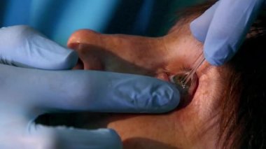 Tıbbi Masaj göz kapakları, göz kapakları, Doktor tıbbi prosedürü yapmak Tıbbi Masaj göz kulak