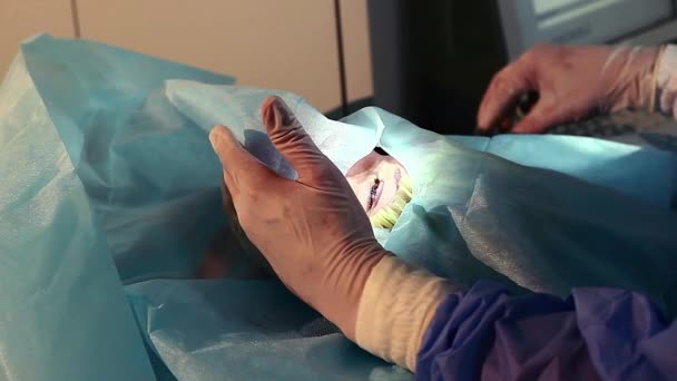 Operation Eye Cataract Surgery Doctor Ophthalmic Operating Room Surgeon Hands — Stock Video