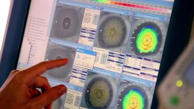 Doktor hasta göz muayenesi ve sonuç Kliniği, üstünde belgili tanımlık perde LCD ekran, monitör, oftalmik görevliler monitör ekranında gözün kornea gözün kornea Oftamolojik incelenmesi ekranda izlerken tutar