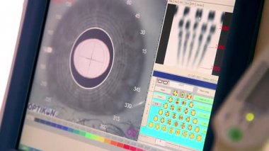 Doktor hasta göz muayenesi ve sonuç Kliniği, üstünde belgili tanımlık perde LCD ekran, monitör, oftalmik görevliler monitör ekranında gözün kornea gözün kornea Oftamolojik incelenmesi ekranda izlerken tutar
