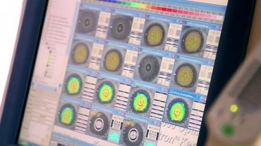 göz testi, phoropter göz hastalıkları kliniği, göz muayene testi bir profesyonel tıbbi cihazlar ekranda kadın hastaya inceleyerek Optometrist Doktor tıbbi malzeme ayarlar