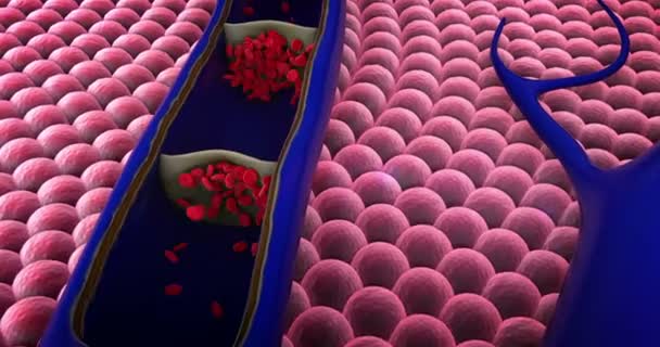 Artéria Mostrada Com Uma Seção Recortada Contração Vasos Sanguíneos Coágulo — Vídeo de Stock