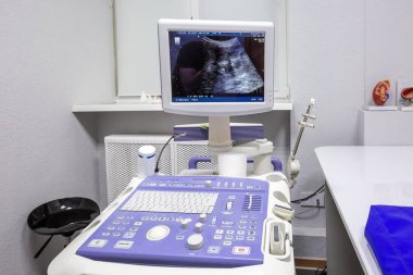 Minsk, Belarus 'taki modern laboratuvarda ultrason makinesi. Minsk, Belarus - 21 Temmuz 2020.