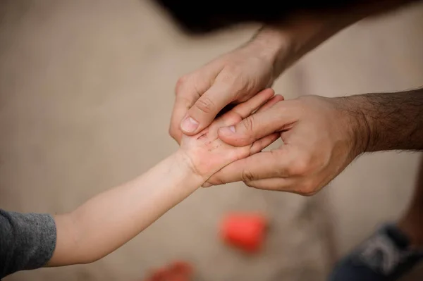 Carregando Mãos Pai Segurando Pequeno Filho Mão Com Arranhões Frescos — Fotografia de Stock